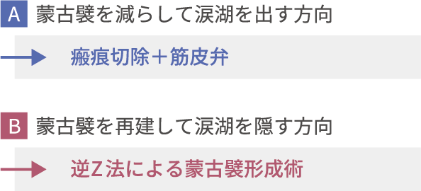 蒙古襞形成の方向 A・B解説